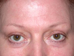 Brows before Permanent Cosmetics